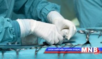 Согтуу эмч өвчтөнд мэс засал хийжээ