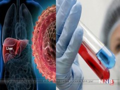 Элэгний вирус илрүүлэх үнэ төлбөргүй шинжилгээ маргааш эхэлнэ  