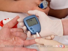 Чихрийн шижин өвчнийг эмчлэх “ЧИ Ю” гутлын аргыг  Монголд туршжээ