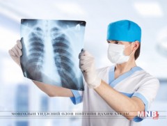 Монголд их, дээд сургуулийг эмч мэргэжлээр төгсөгчийн тоо хангалттай байна