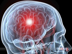 Тархинд цус харвалтын шалтгаан