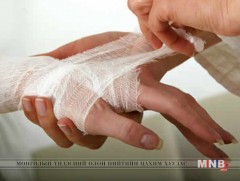 Осголт, хөлдөлтөөс урьдчилан сэргийлээрэй