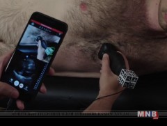 Зөөврийн зориулалтын хэт авианы дуран бүхий төхөөрөмж “ IQ” 