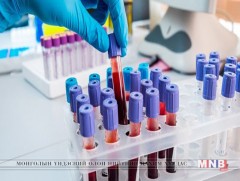 Говь-Алтайн долоон хүн тутмын нэг нь В, есөн хүн тутмын нэг нь С вирустай байна 