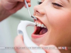 “Эрүүл шүд-эрүүл хүүхэд” үндэсний хөтөлбөрийг батлав