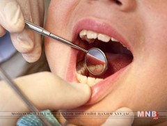 0-5 насны хүүхдүүдийн 48,7 хувь нь шүдний өвчлөлтэй байна