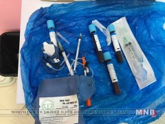 Мэргэжлийн бус гоо сайханчаар филлер хийлгэж эрүүл мэндээрээ хохирсон байна