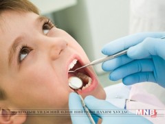 Зуун хүүхдийн гурав нь эрүүл шүдтэй байна