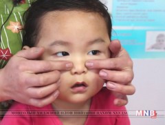 Дархлаа сайжруулах цэгэн иллэг 