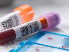 Элэгний вирус илрүүлэх үзлэг Өвөрхангай аймагт үр дүнтэй хэрэгжиж байна