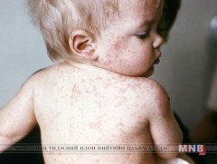 Хүүхдэдээ тарилга хийлгээгүй эцэг эхчүүдийг торгоно