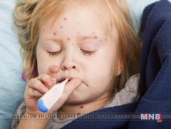 Товлолт вакцинд хамрагдаагүй хүүхдүүд улаанбурханаар өвдөх эрсдэл өндөртэй