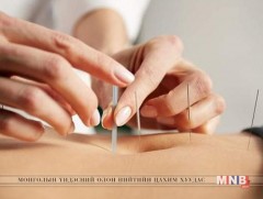 Эмчлэх эрхгүй хүнээр хануур хатгуур хийлгэснээс болж эмнэлэгт ханджээ