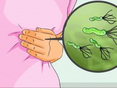 Хеликобактертай гурван хүн тутмын нэг нь ходоодны хорт хавдраар өвчлөх эрсдэлтэй