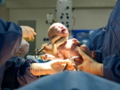 Эх баригчид 4-5 дахин ачаалалтай ажиллаж байна 