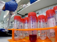 АНУ-д шинэ төрлийн коронавирусийн анхны тохиолдол бүртгэгдлээ  