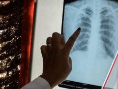 Хятад улсад үл мэдэгдэх вирус тархаж байна