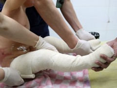 “Түлэнхийн нөхөн сэргээх тасаг”-т эмчлүүлэгсдийн 80 гаруй хувь нь хүүхэд байна