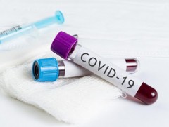 “Ковид-19” халдварын 37 тохиолдол шинээр нэмэгдэж, нийт халдварын батлагдсан тоо 555 боллоо