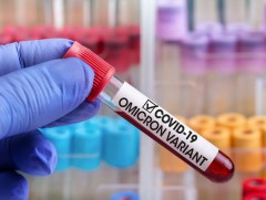 “Омикрон” хувилбар бүртгэгдсэн тохиолдолд сорьцыг дотоодод шинжлэх боломжтой