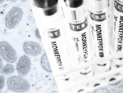 Өрнөдийн орнууд сармагчны цэцэг өвчнөөс сэргийлэхийн тулд вакцин нөөцөлж байна 