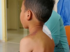 Могойд хатгуулсан хүүгийн амь цусны доноруудын ачаар аврагджээ