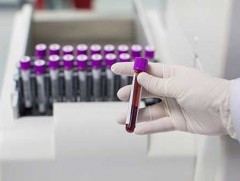 Эрт илрүүлэг, үзлэг шинжилгээгээр хортой болон хоргүй хавдрын 2795 сэжигтэй тохиолдол бүртгэгджээ 