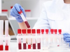 Урьдчилан сэргийлэх, эрт илрүүлэг үзлэг шинжилгээнд 800 гаруй мянган хүнийг хамруулжээ