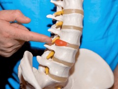 ГССҮТ-өөс Турк улсын эмч нартай хамтран нуруу, нугасны чиглэлээр үзлэг, эмчилгээ хийнэ