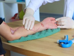 ГССҮТ-д гэмтлийн дараах хөдөлмөр заслын тусламж үйлчилгээг үзүүлж байна