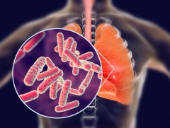 Сүрьеэ өвчний талаар иргэд олон нийтэд мэдээлэл өглөө