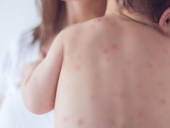 Улаанбурханы лабораториор батлагдсан 59 тохиолдол бүртгэгдлээ   