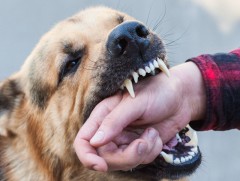 Өдөрт 20 орчим хүүхэд нохойд хазуулж эмнэлэгт хандаж байна