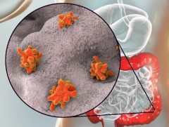 Гэдэсний халдварт өвчин нэмэгддэг улирал ирлээ 