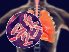 Сүрьеэ өвчний улмаас жилд 200 орчим иргэн амь насаа алдаж байна