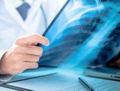 Монгол Улс сүрьеэгийн өвчлөл өндөртэй орны тоонд багтаж байна